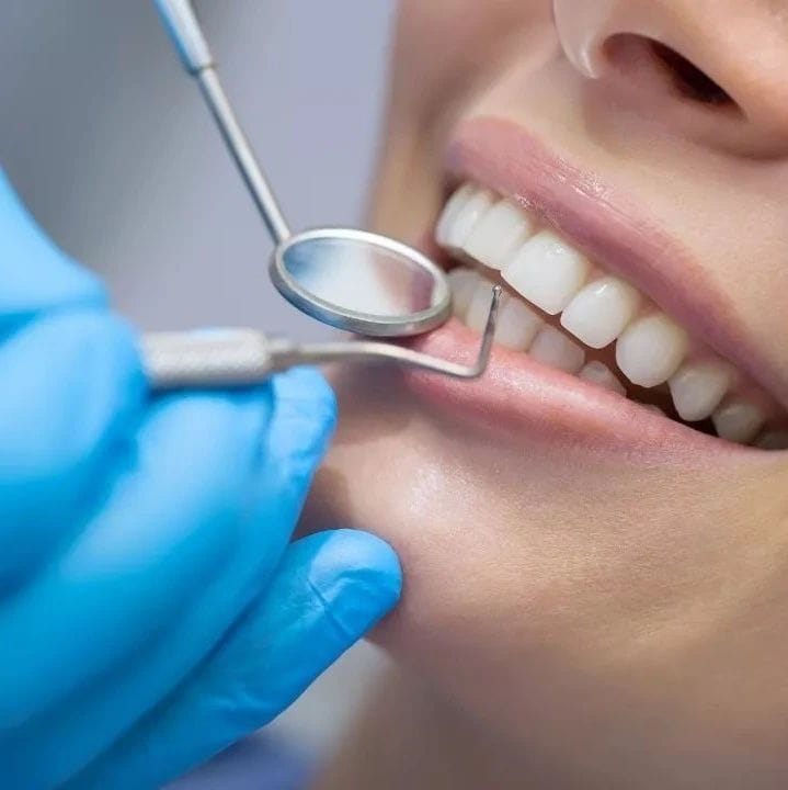 how long do dental implants last