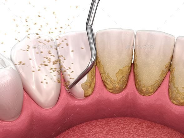 Oral Prophylaxis Benefits Procedure Guide
