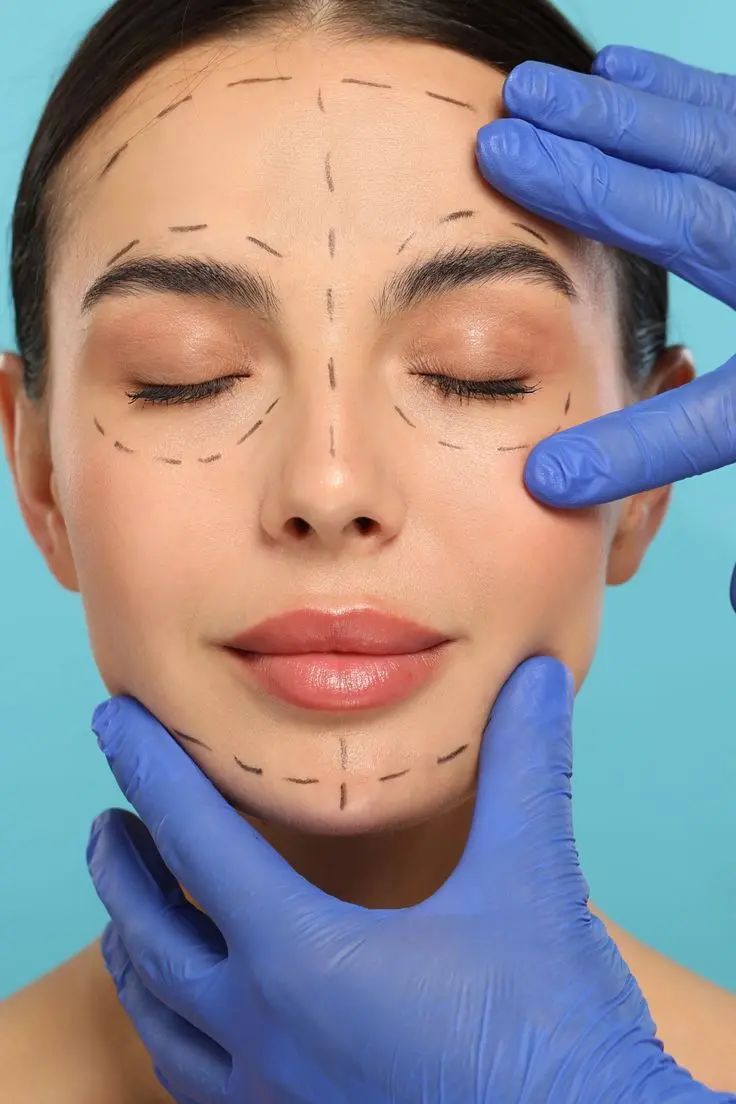 Facial Fracture Treatment at Vijaya Dental Hyderabad
