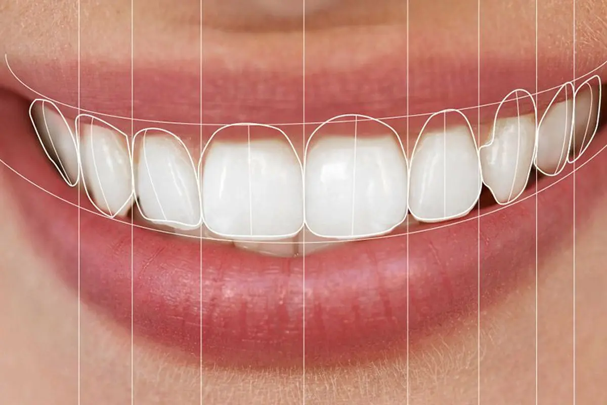 Smile Designing and Correction Hyderabad